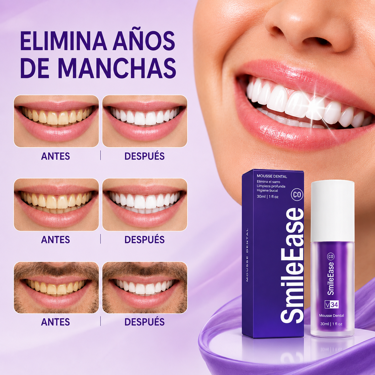 SmileEase® I Pasta Blanqueadora de Dientes